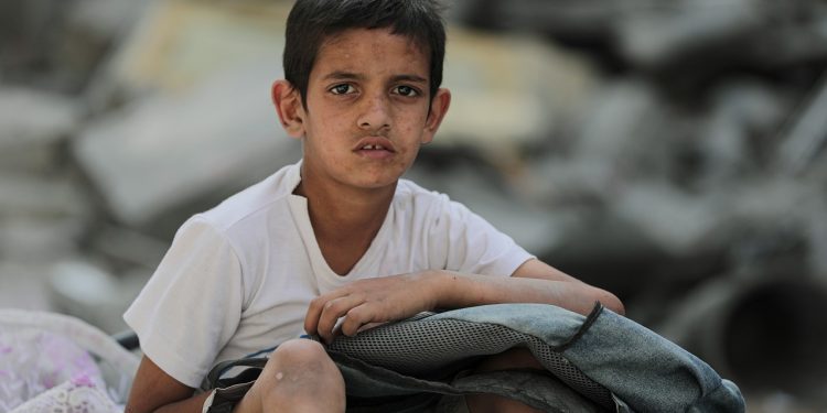 Gaza anak-anak penyakit kulit