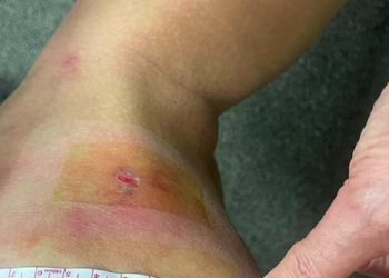 turis australia tomcat